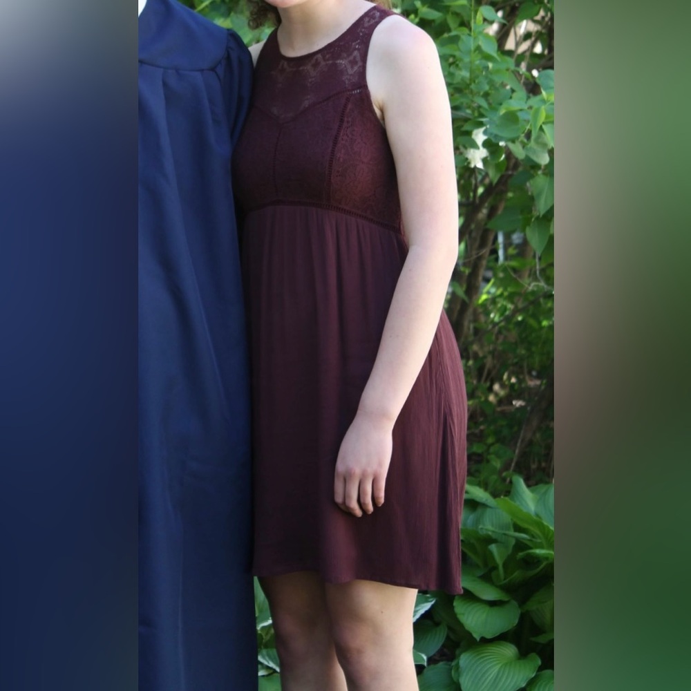 Abercrombie Lace Open Back Dress - Picture 8 of 8